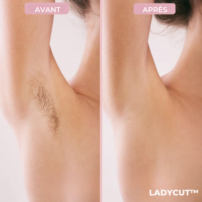 LadyCut™ – Fini les irritations et les coupures